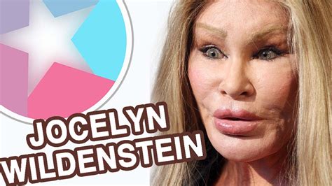 Does Jocelyn Wildenstein Have Children