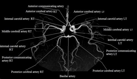 Radiology Anatomy Images : MRA Brain anatomy