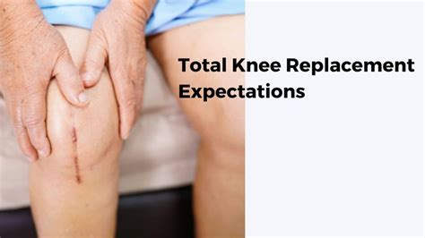 Total Knee Replacement Recovery Time Swelling Archives - Enliven Articles