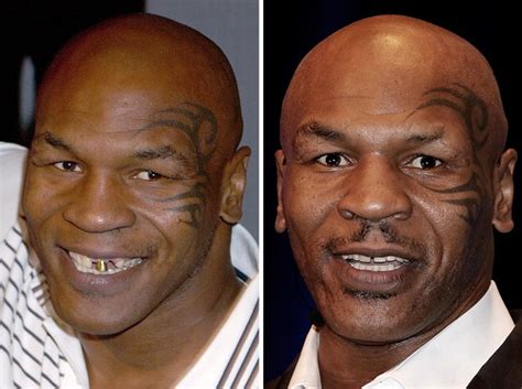 Mike Tyson Before and After