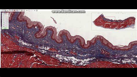 Histology Of The Pharynx - YouTube