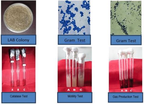 A series of lactic acid bacteria identification tests. | Download ...