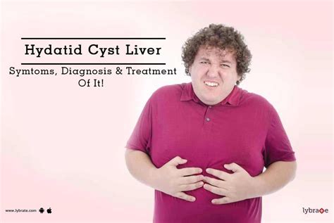 Hydatid Cyst Liver - Symtoms, Diagnosis & Treatment Of It! - By Dr ...