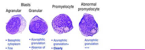 Promyelocyte Lineage