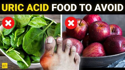 Avoid 9 Indian foods in high uric acid - Credihealth - YouTube