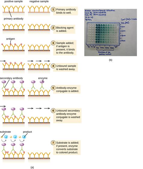 EIAs and ELISAs | Microbiology