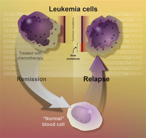 Leukemia survival rate | General center | SteadyHealth.com