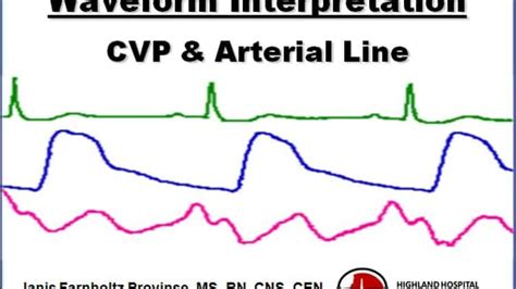 CVP & Arterial Line Waveform Interpretation on Vimeo | Arterial line ...