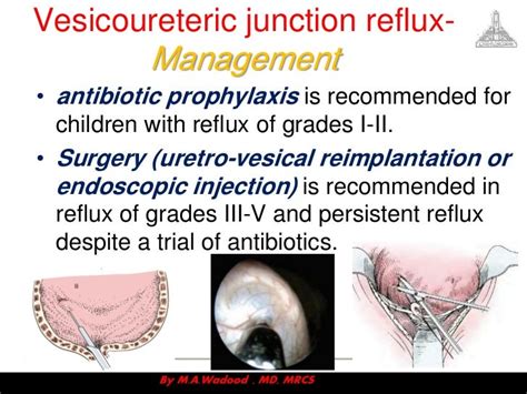 Congenital anomalies ppt