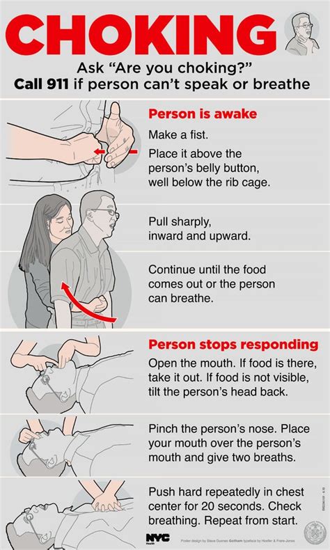 At 96, Dr. Heimlich Uses His Own Maneuver on Choking Victim - The New ...