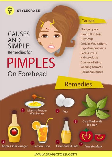 10 Causes And Simple Remedies For Pimples On Forehead | Pimples on ...