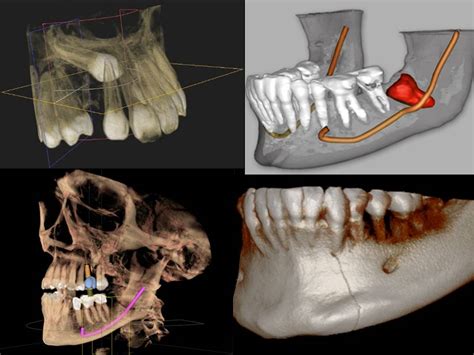 Technology Spotlight: The Dental Cone Beam CT - Gateway Oaks Dental