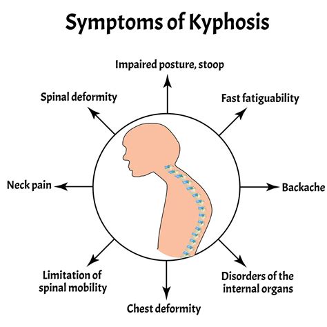 Kyphosis | Vejthani Hospital