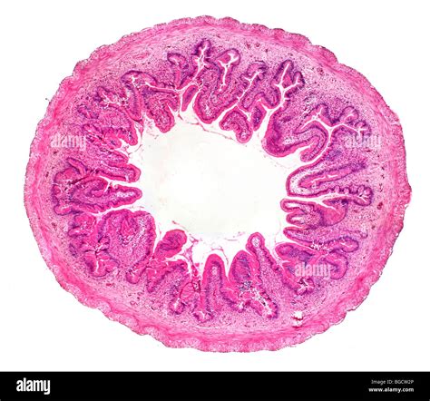 Frog small intestine TS showing villi nutrient absorption 'finger' like ...