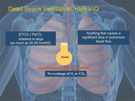 CC - EtCO2 and Waveform Capnography