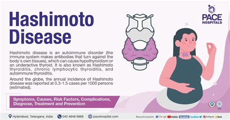 Hashimoto's thyroiditis | Hashimoto’s disease – Symptoms & Causes