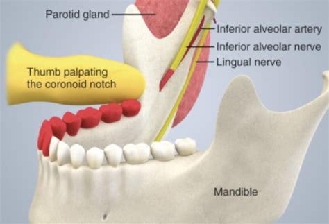 Inferior Alveolar Nerve Block Landmarks