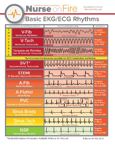 Basic EKG ECG Rhythms Cheatsheet - Copy - Basic EKG/ECG Rhythms V-Fib V ...