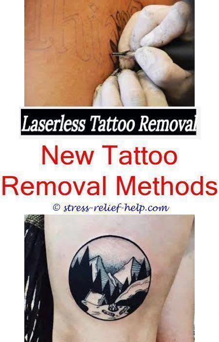 Diy tattoo removal methods.Salabrasion tattoo removal before and after ...