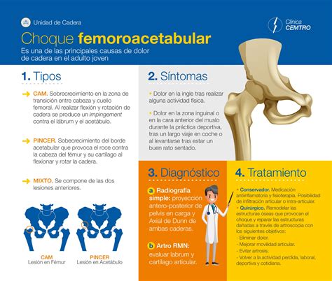 Lista 9 Foto Técnicas De Movilización De Pacientes Con Fractura De ...