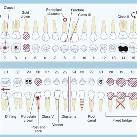 Dental Charting Symbols | World Of Template & Format throughout Dental ...