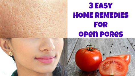 Open Pores Home Remedy | Shrink and Close Large Pores with DIY Face ...