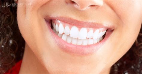 Can Teeth Whitening Damage Gums?