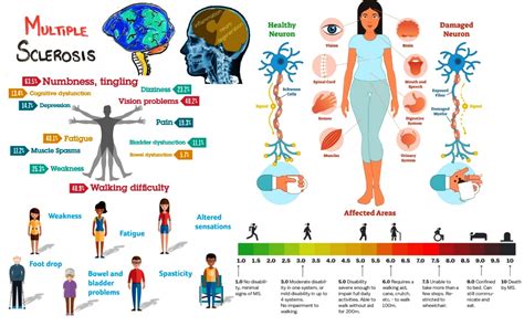 Multiple Sclerosisomeopathic treatment known as MS Demylation Nerve Disease