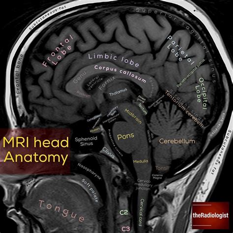 Read on for my tips at looking at a sagittal view MRI of the brain ...