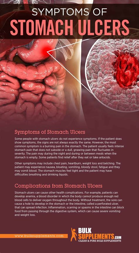 Bleeding Duodenal Ulcer