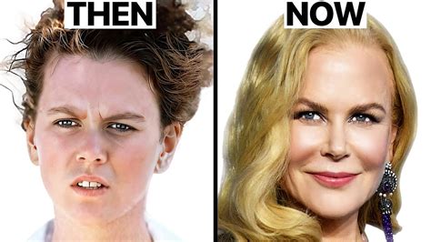 Nicole Kidman's NEW FACE | Plastic Surgery Analysis - Cyber Clinic