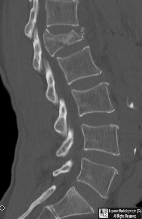 LearningRadiology - Archives, case of week, 2013