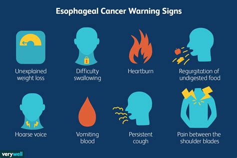 What Is Squamous Cell Carcinoma Of The Throat