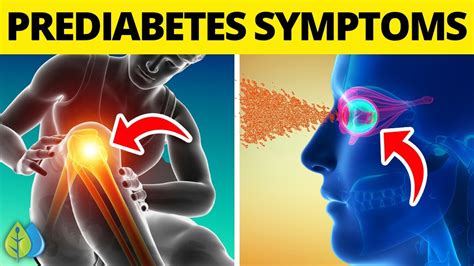 Top 12 Prediabetes Symptoms and Treatment You Need to Know Now - YouTube