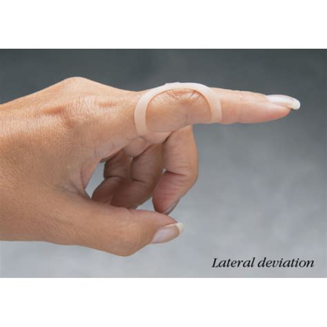 Oval-8 Mallet Finger Splint Singapore - Oval 8 Trigger Finger Splint ...