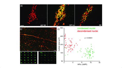 | Neutrophils with high nuclear levels of HIF-1a under hypoxia display ...