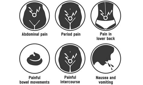 Types of Ovarian Cysts, Symptoms, Diagnosis & Treatment