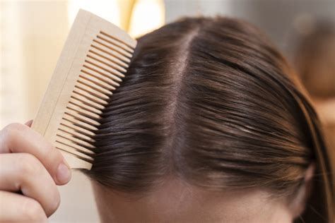 4 signs that you’re suffering from scalp inflammation – and what to do ...