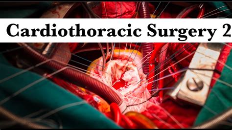 Cardiothoracic surgery Revision part 2 by ASM Minds Team - YouTube