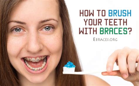 How to Brush Your Teeth with Braces Properly