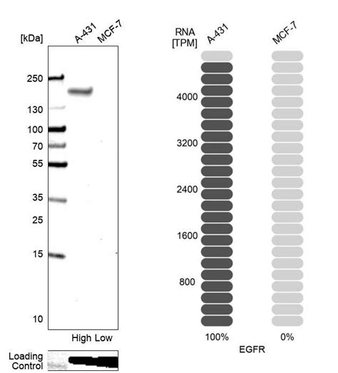 Rabbit Polyclonal Anti-EGFR Antibody - Buy for research - Highly ...