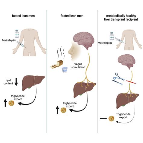 Hormone protects against development of fatty liver