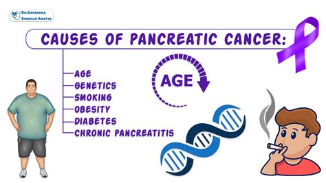 Causes-of-pancreatic-cancer - Dr. Kapendra Shekhar Amatya