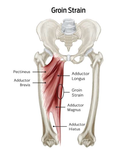 Understanding the Anatomy of Groin Muscles: A Comprehensive Guide ...