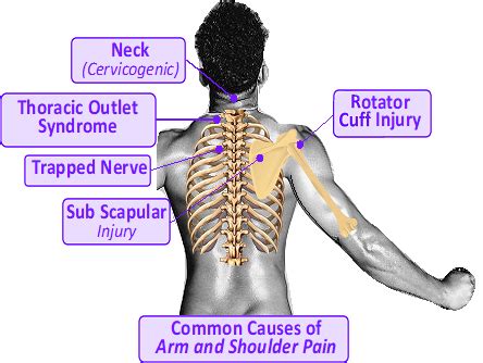 How To Cure Shoulder And Neck Pain - Tomorrowfall9