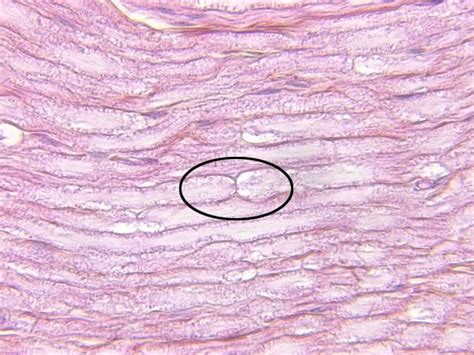 Chapter 8, Page 6 - HistologyOLM 4.0 | Peripheral nerve, Chapter, Circle