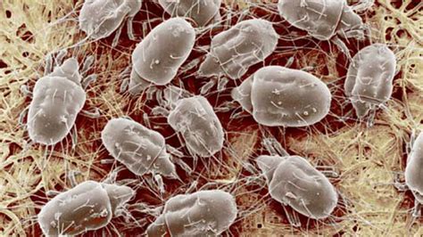 How To Get Rid Of Dust Mites: 10 Things You need to Know