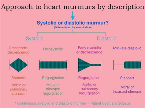 USMLE Approach to heart murmur questions - Ecuadoctors