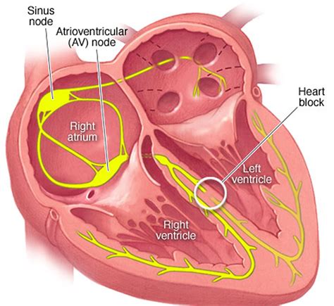 Left Bundle Branch Anatomy