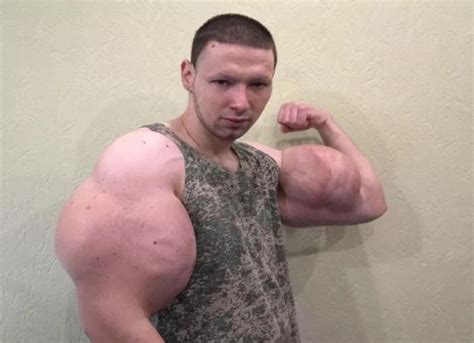 Man injected oil into his biceps, he fears losing arms - Afrinik